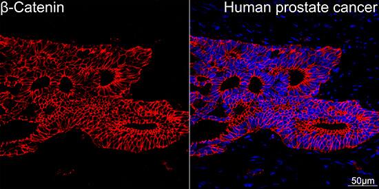 beta-Catenin Antibody (6A3P2)
