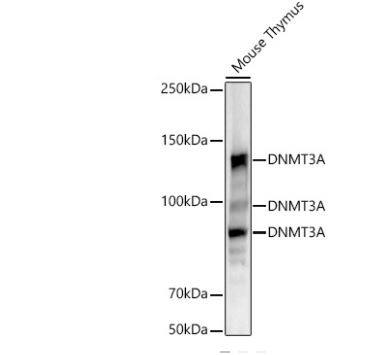DNMT3A Antibody (7L9O3)