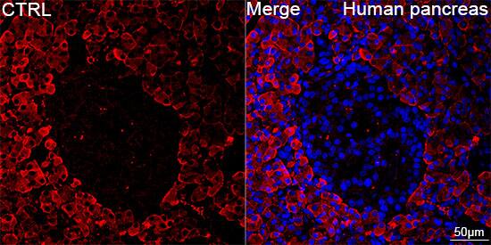 Chymotrypsin-like protease Antibody (10Z4K3)
