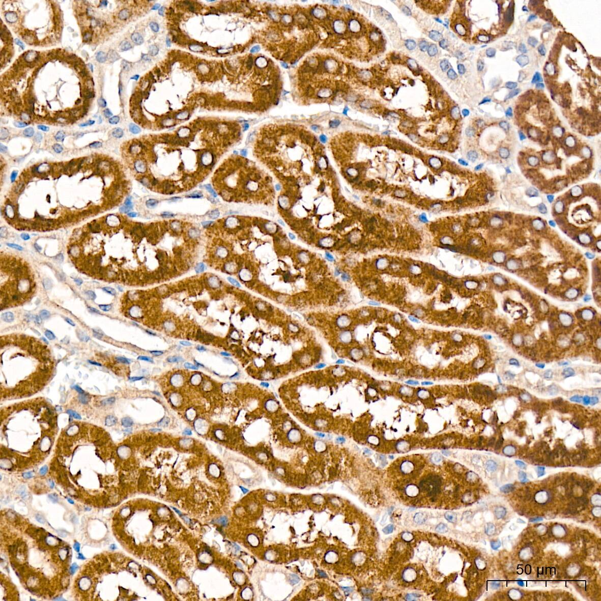 Cytochrome P450 4A Antibody (10D10W7)