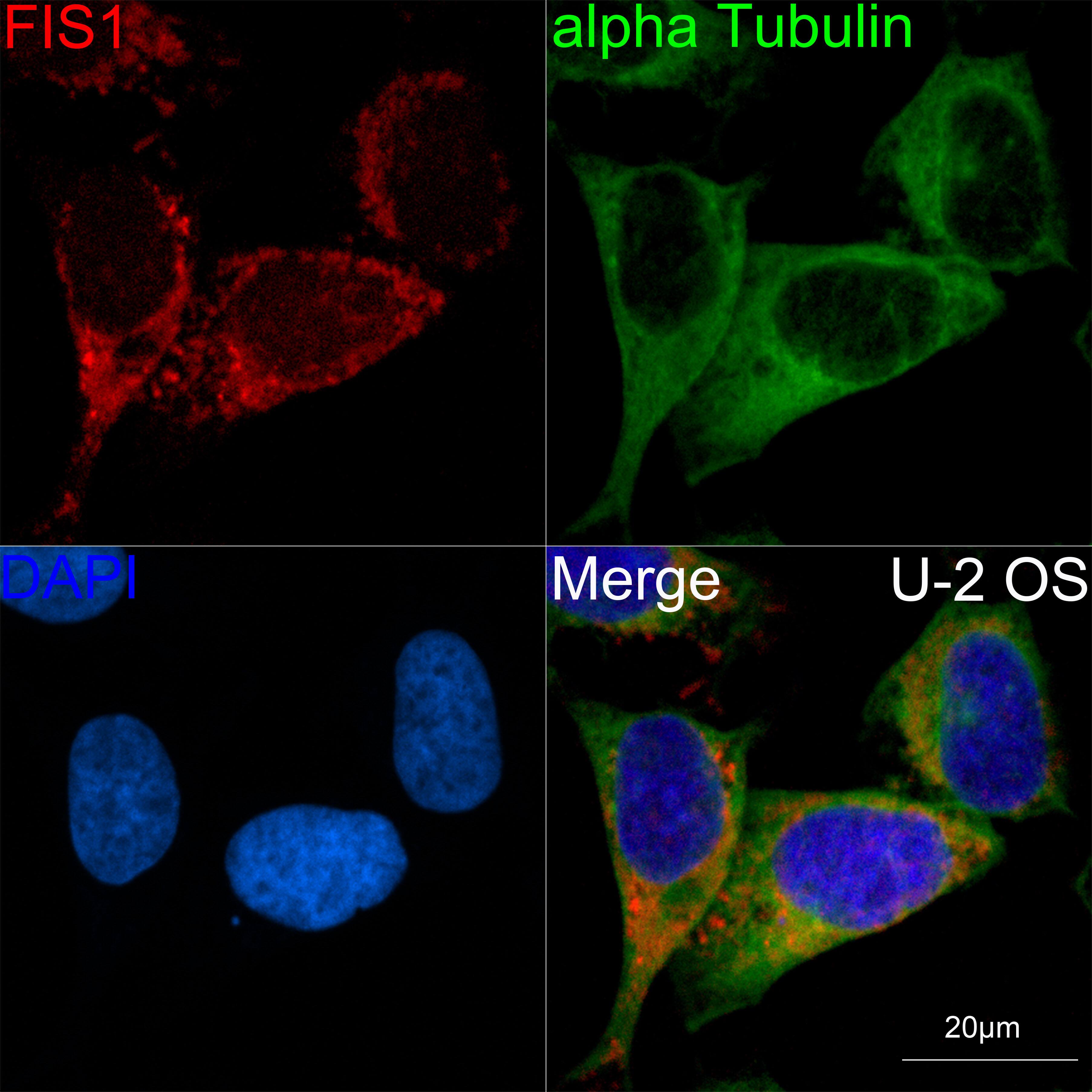 TTC11 Antibody (6S1G4)