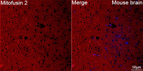Mitofusin 2 Antibody (4H10F8)