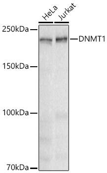 DNMT1 Antibody (1K5K8)
