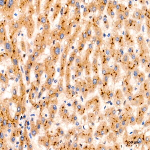 PIM1 Antibody (4C8D0)