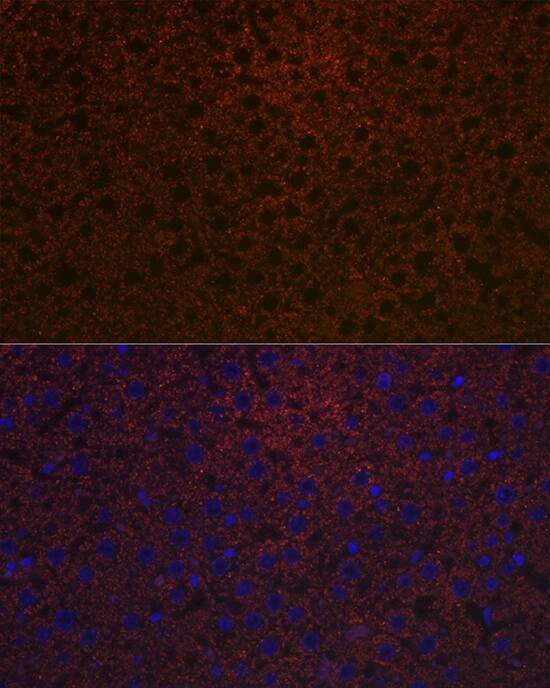 Ceruloplasmin Antibody (6C3K9)