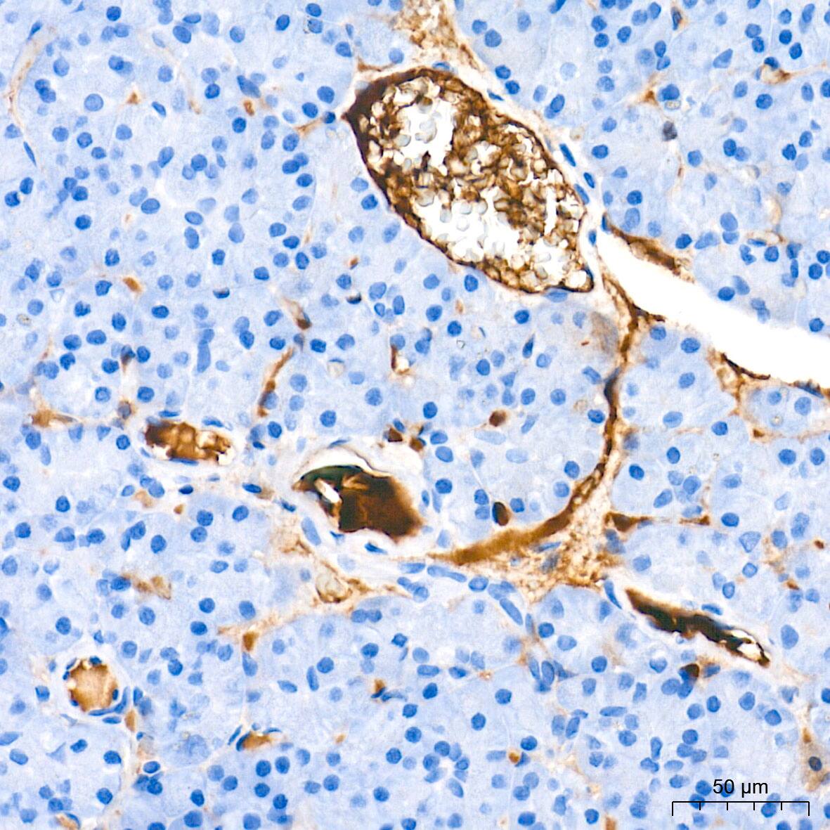 Ceruloplasmin Antibody (6C3K9)