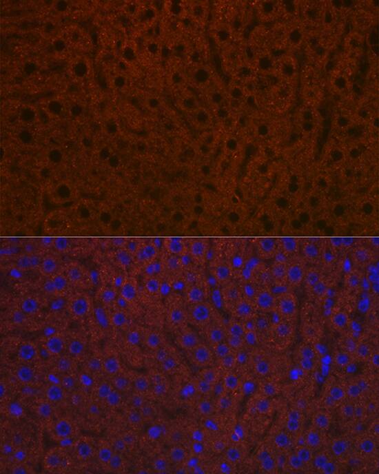 Ceruloplasmin Antibody (6C3K9)
