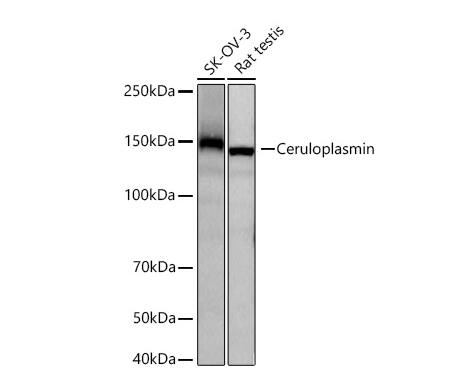 Ceruloplasmin Antibody (6C3K9)