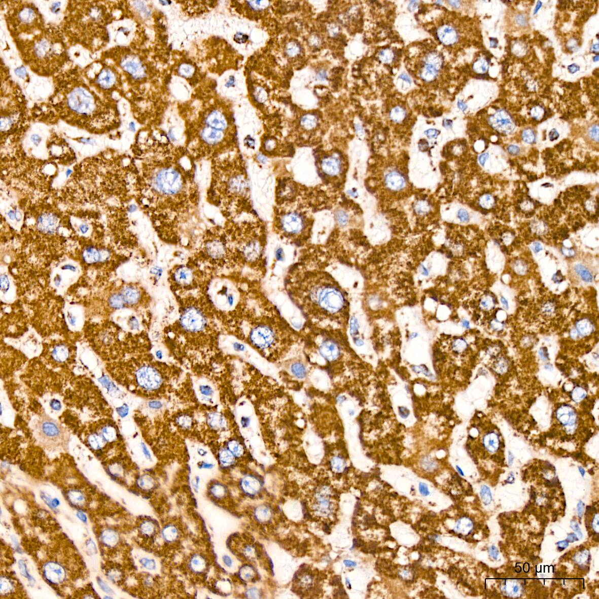 VDAC1 Antibody (6B1K1)