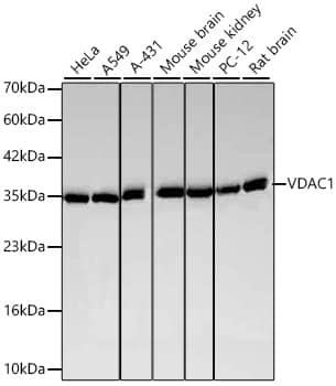 VDAC1 Antibody (6B1K1)