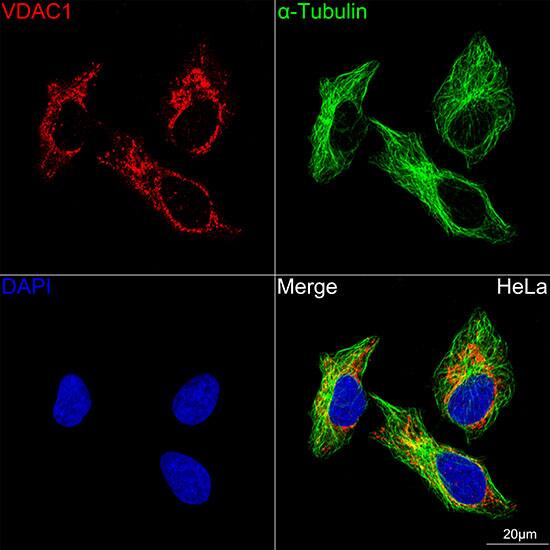 VDAC1 Antibody (6B1K1)