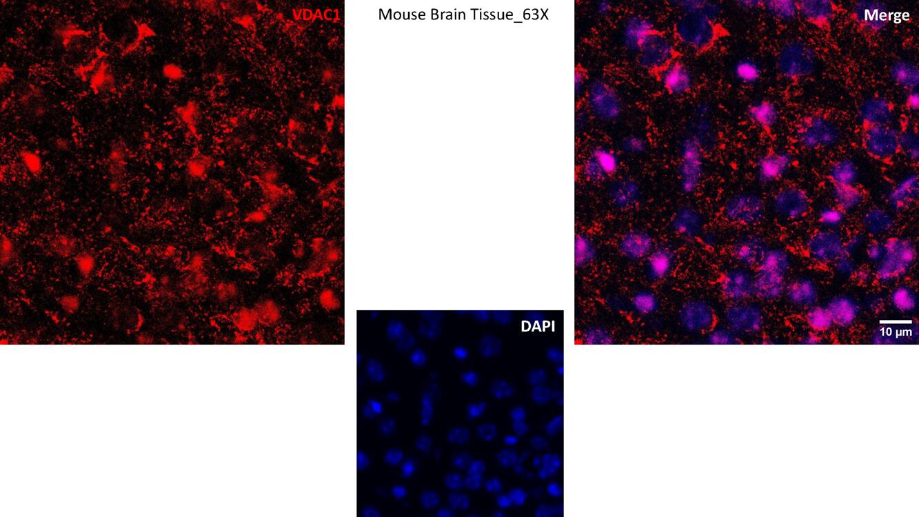 VDAC1 Antibody (6B1K1)