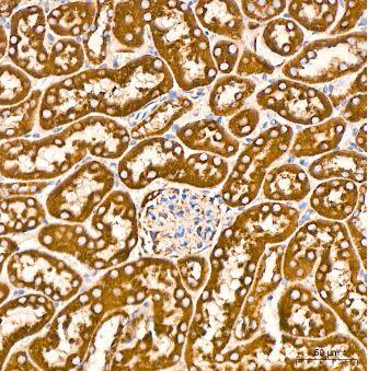 VDAC1 Antibody (6B1K1)