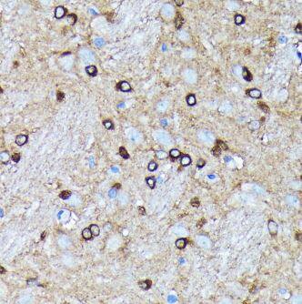 Ago2/eIF2C2 Antibody (10S10L5)