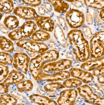 Ago2/eIF2C2 Antibody (10S10L5)