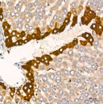 Ago2/eIF2C2 Antibody (10S10L5)