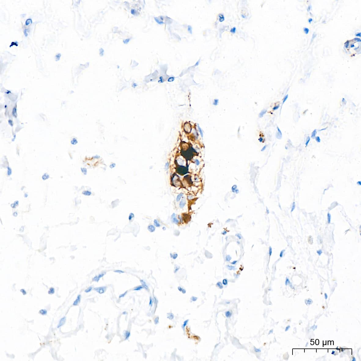 NF-L Antibody (3L9Y10) - Azide and BSA Free