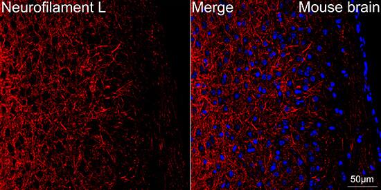 NF-L Antibody (3L9Y10) - Azide and BSA Free