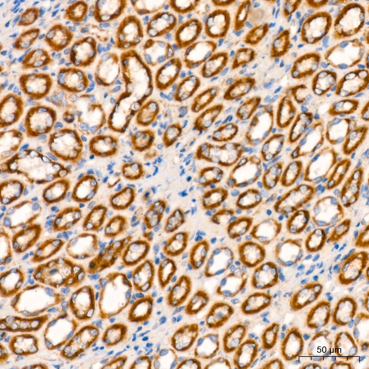NDUFB8 Antibody (6T8G1)