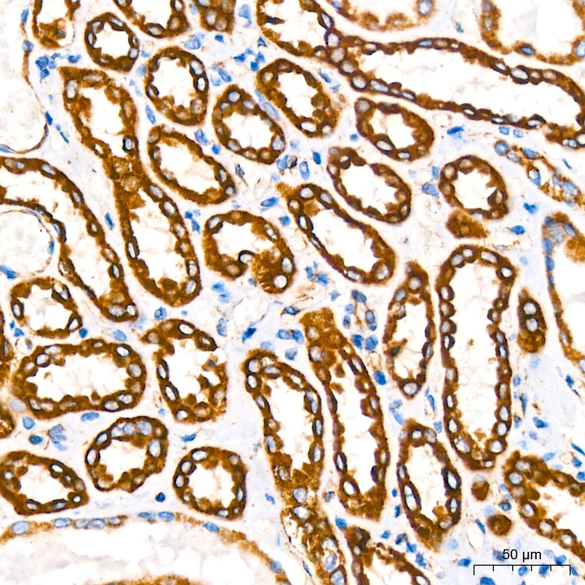 NDUFB8 Antibody (6T8G1)