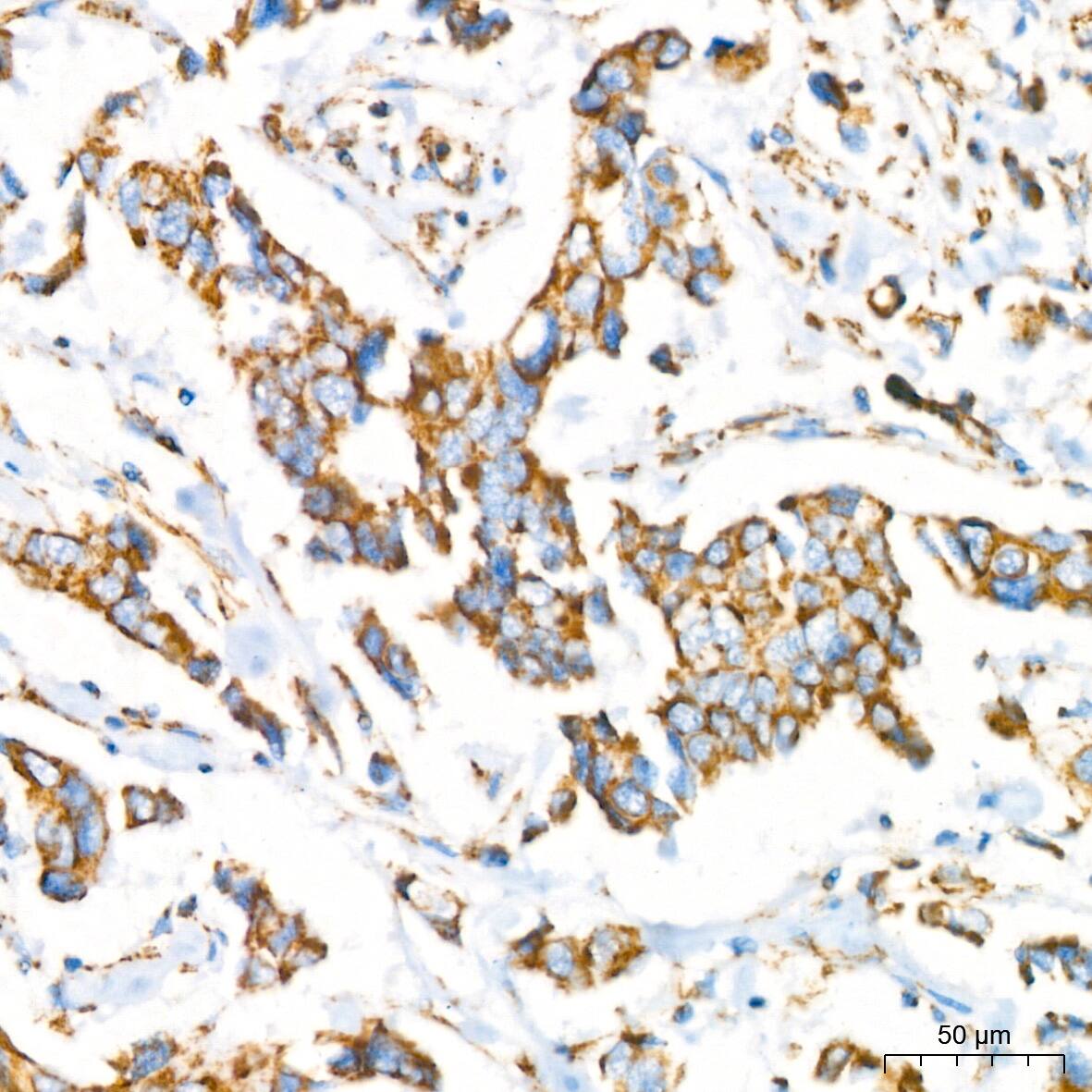 NDUFB8 Antibody (6T8G1)