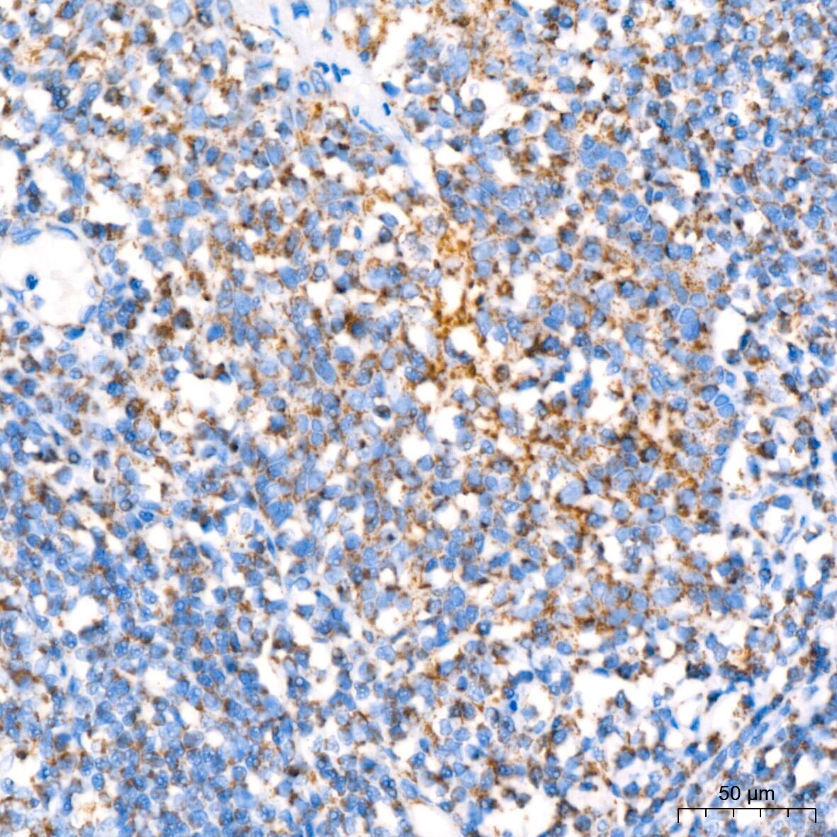 NDUFB8 Antibody (6T8G1)