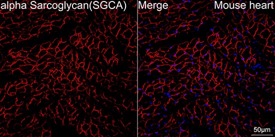 alpha-Sarcoglycan Antibody (3W3Q10)