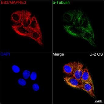 EB3 Antibody (7J9V3)