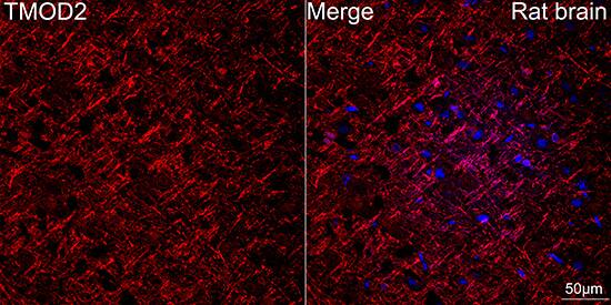 Tropomodulin 2 Antibody (5E7G5)