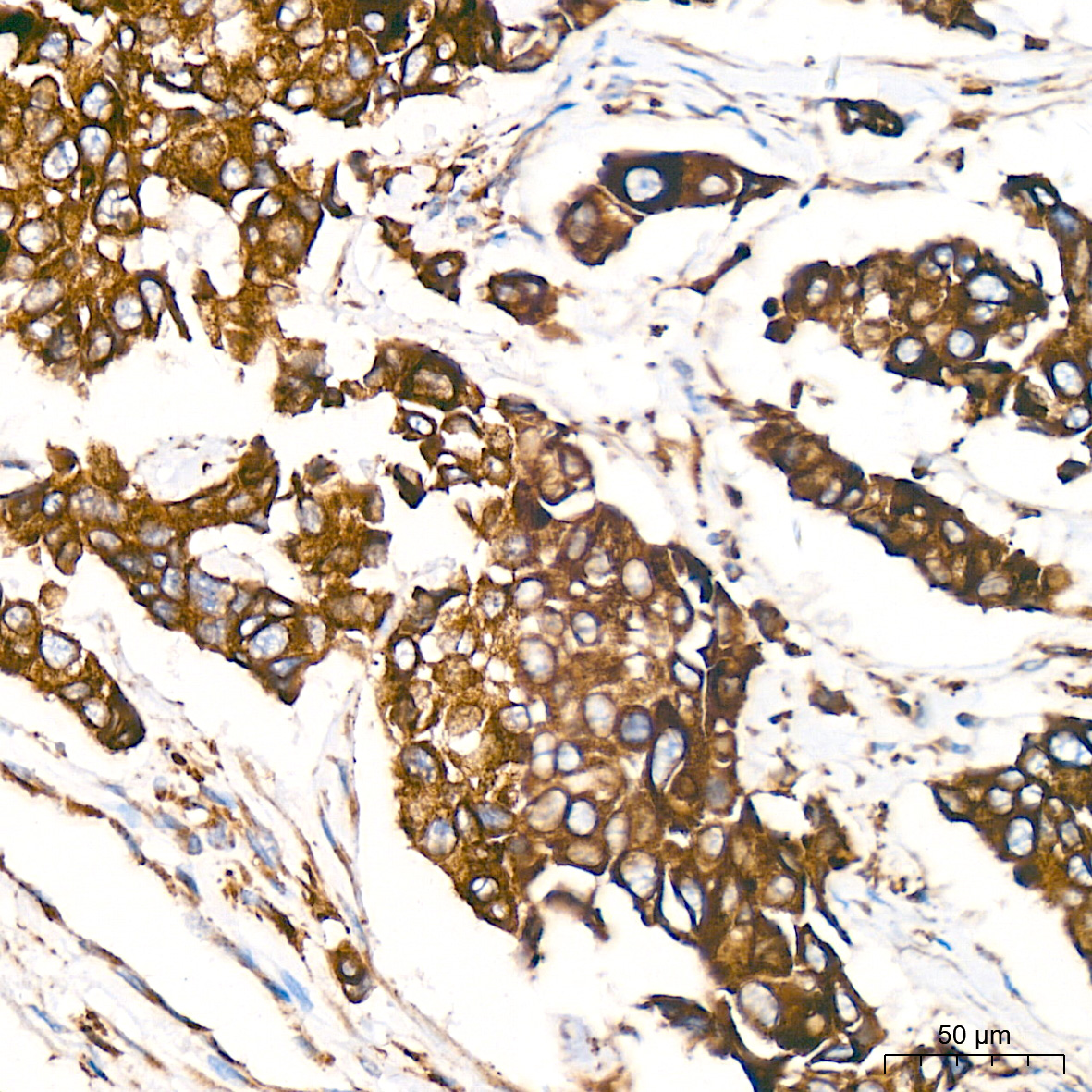ERP29 Antibody (1J0D3)