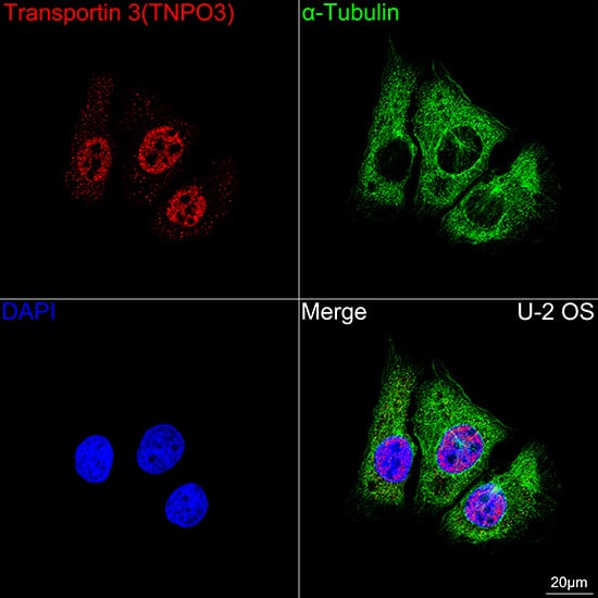 TNPO3 Antibody (0U3Q1)