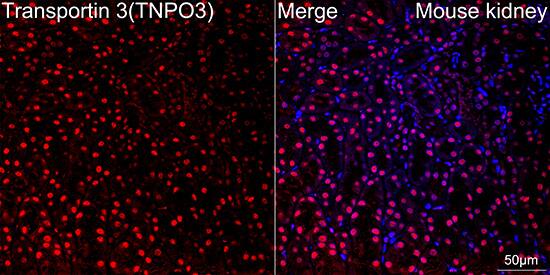 TNPO3 Antibody (0U3Q1)