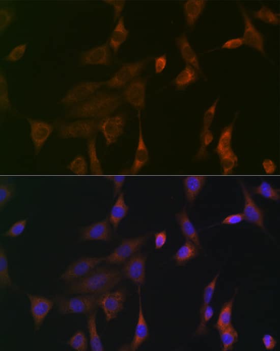 Ras Antibody (6J9I4)