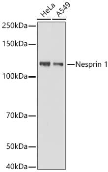 SYNE1 Antibody (1D4D9)