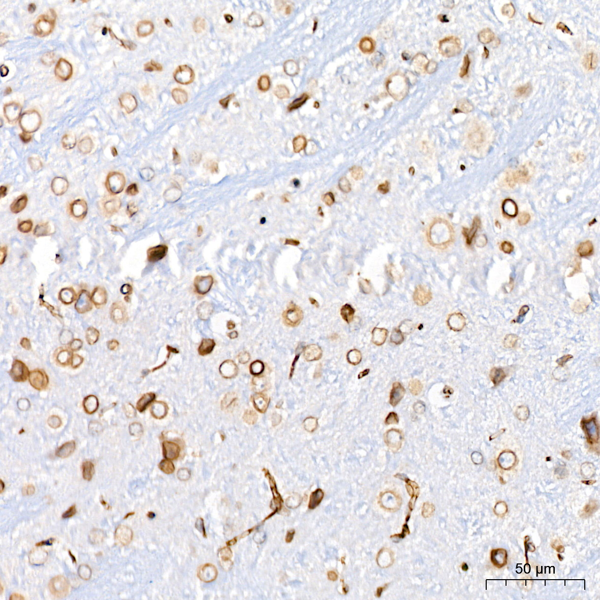 UNC84B Antibody (8E8D7)