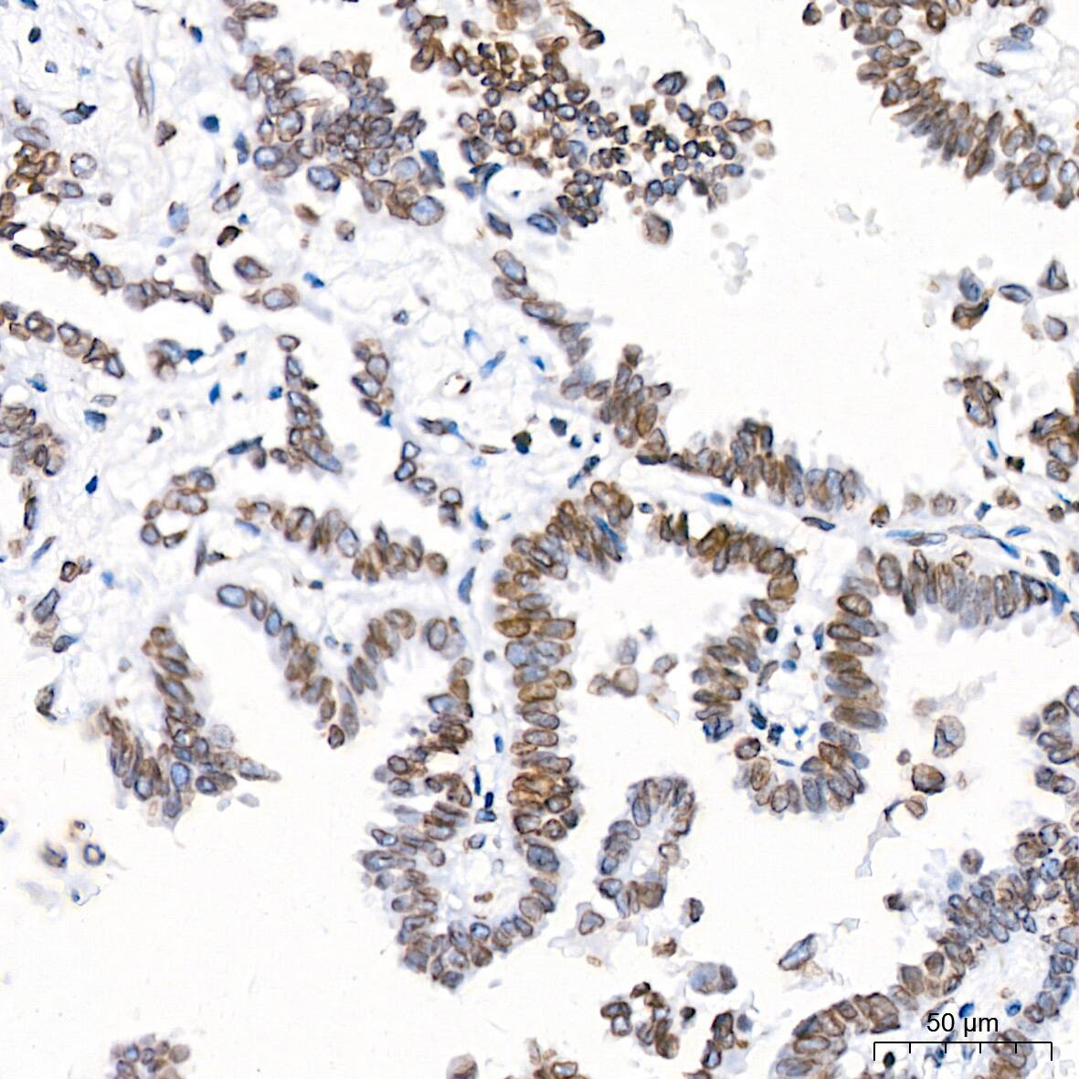 UNC84B Antibody (8E8D7)