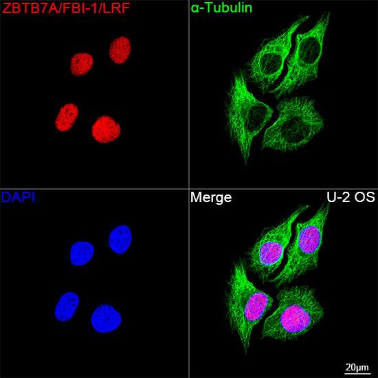 ZBTB7A/Pokemon Antibody (3T2J1)