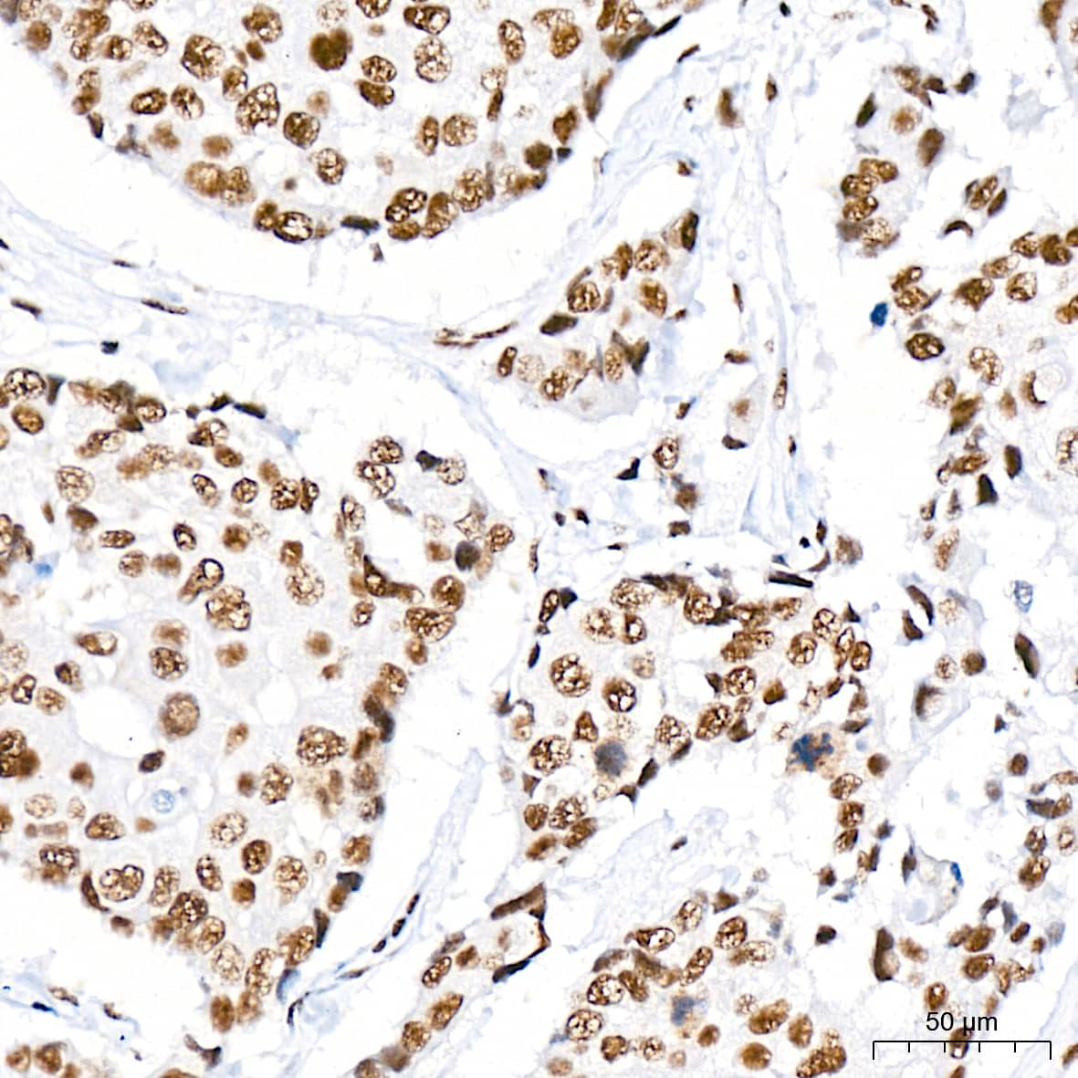 CDC40 Antibody (2I8I7)