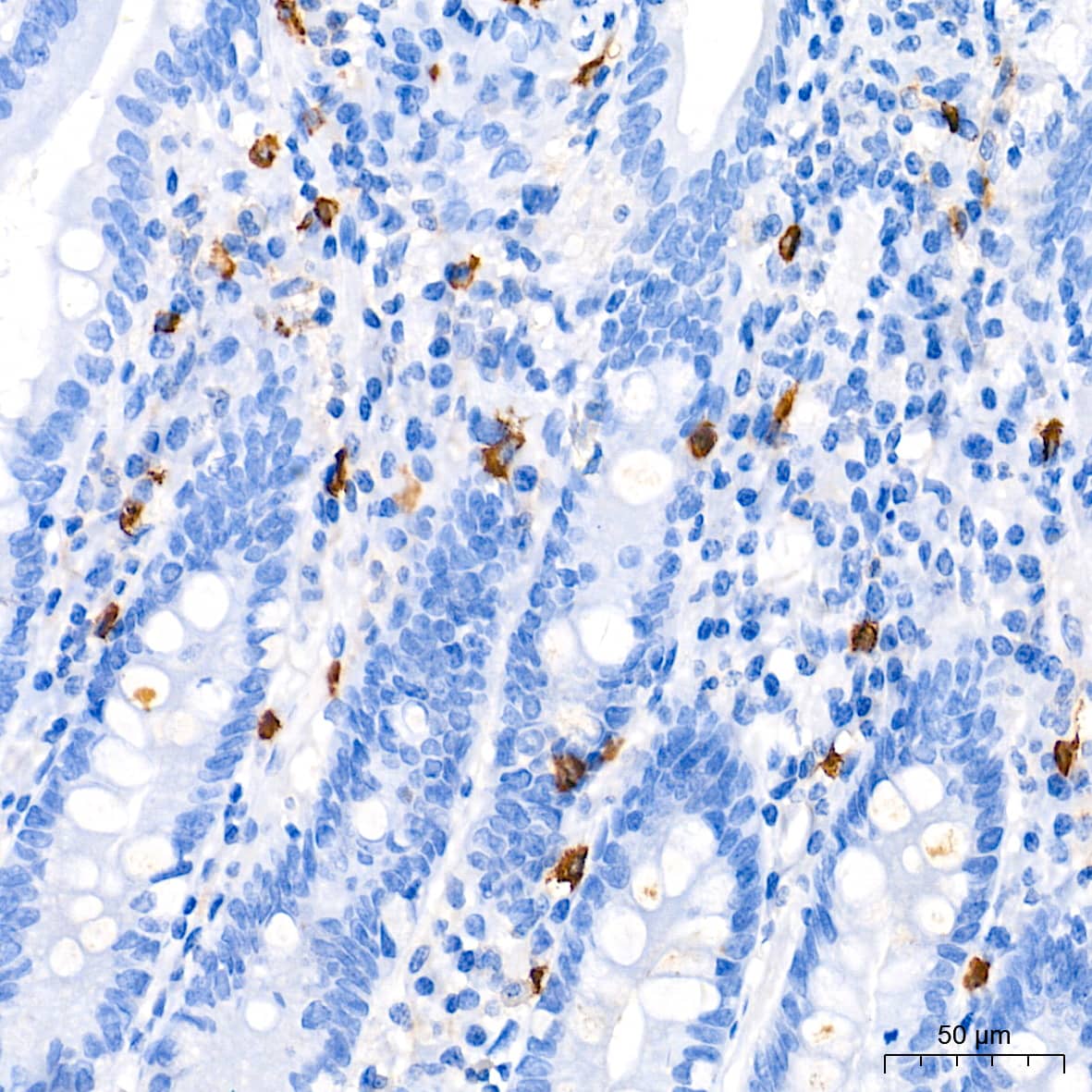 Tryptase beta-2/TPSB2 Antibody (6U1C5)