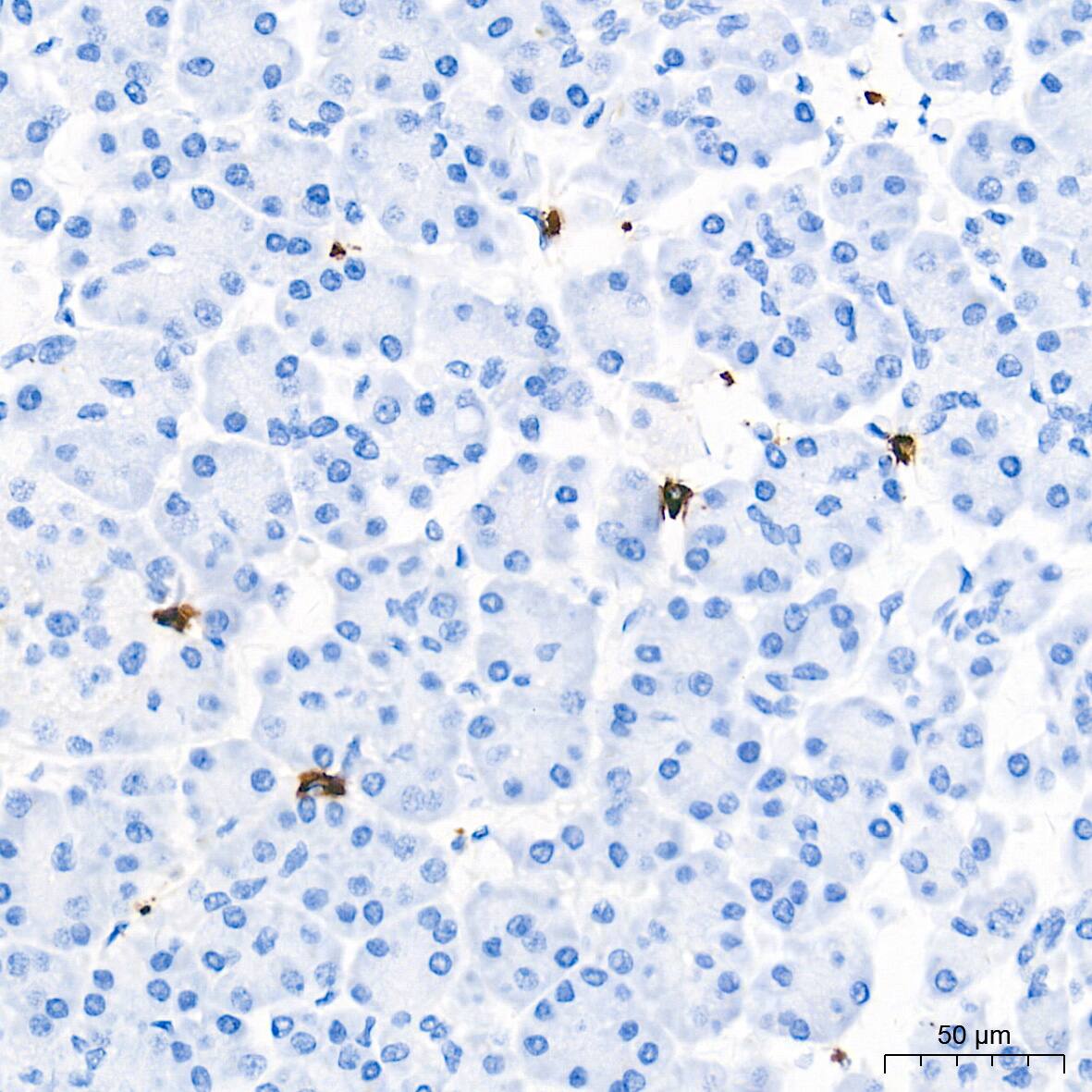 Tryptase beta-2/TPSB2 Antibody (6U1C5)