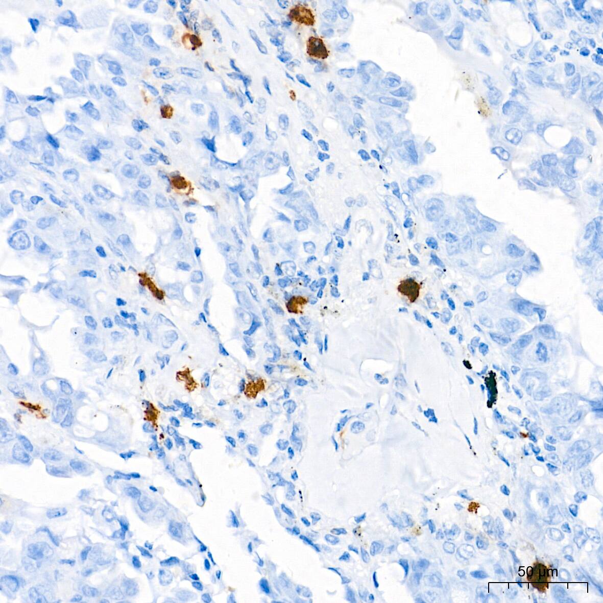 Tryptase beta-2/TPSB2 Antibody (6U1C5)