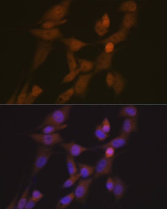 STK33 Antibody (1E4W7)
