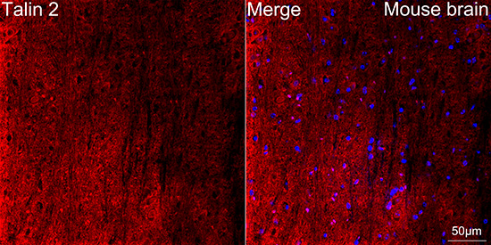 Talin2 Antibody (7D1Y0)