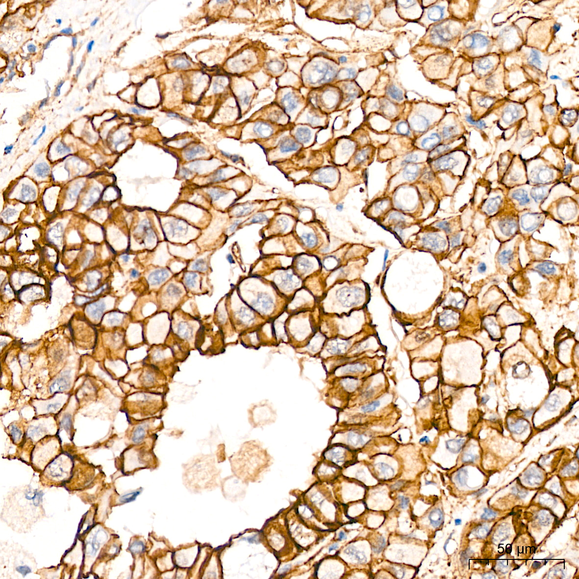 Talin2 Antibody (7D1Y0)