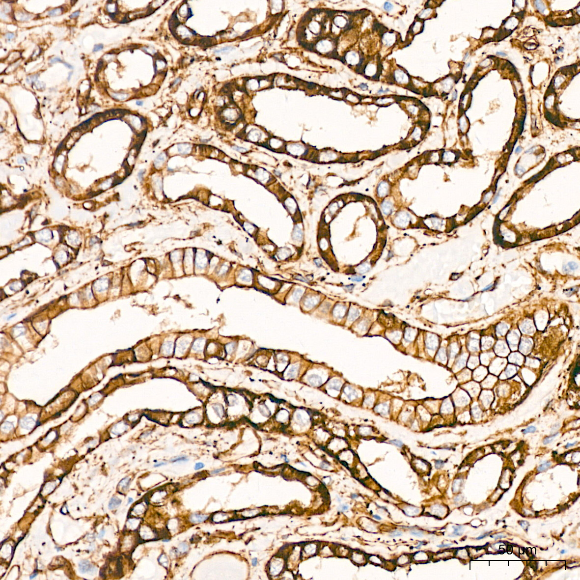 Talin2 Antibody (7D1Y0)