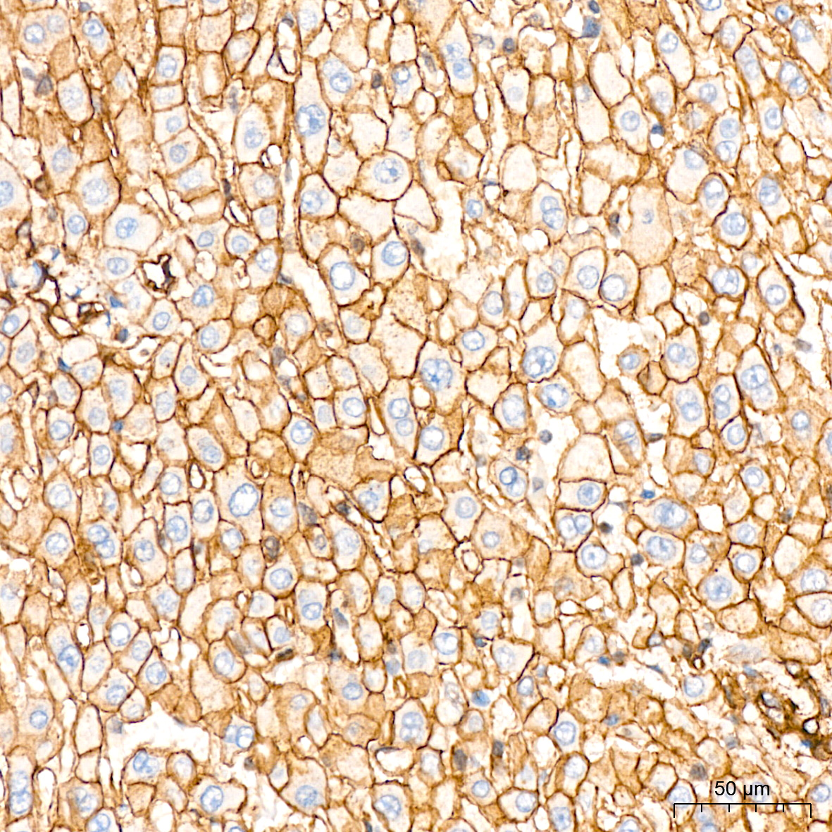 Talin2 Antibody (7D1Y0)