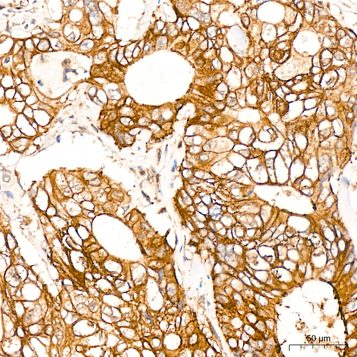 Talin2 Antibody (7D1Y0)