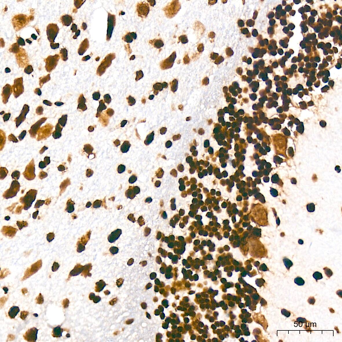 Histone H3 [ac Lys27] Antibody (2V10N10)