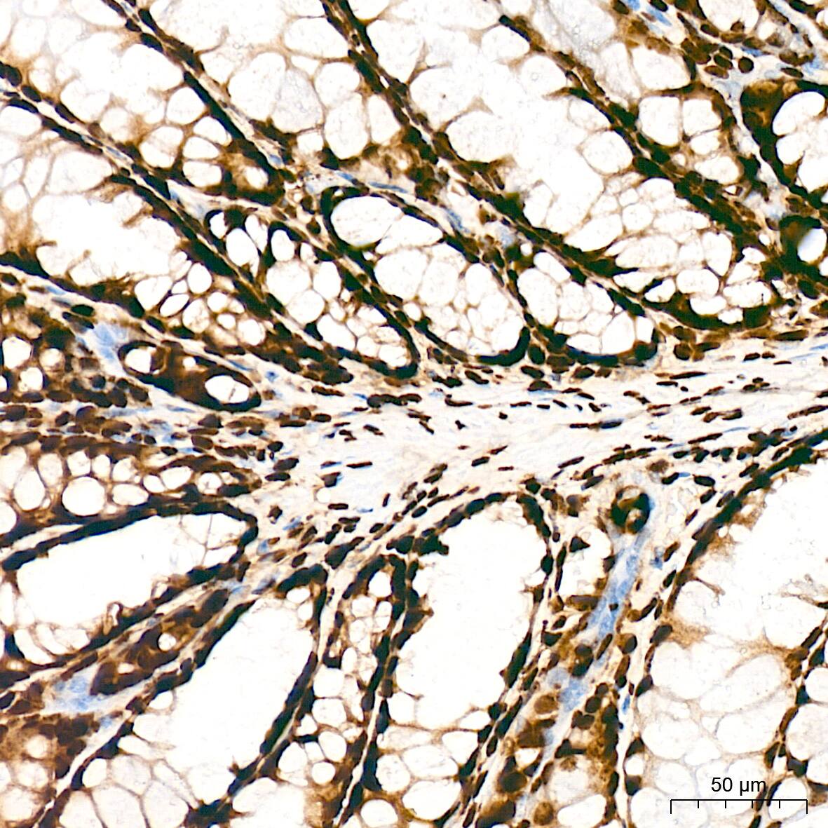 Histone H3 [ac Lys27] Antibody (2V10N10)