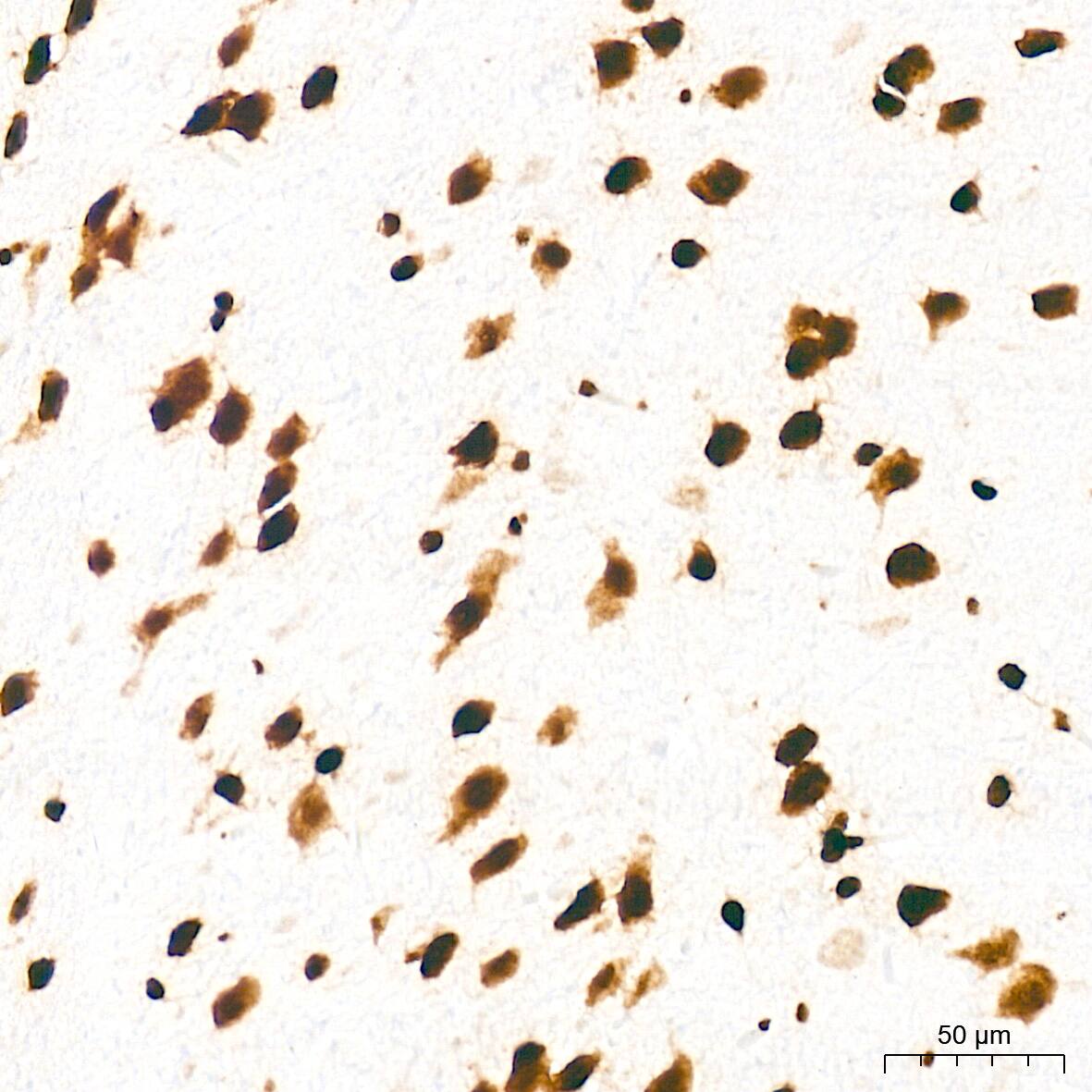 Histone H3 [ac Lys27] Antibody (2V10N10)